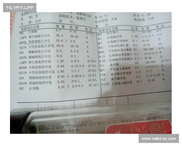 四大满贯联合开展反兴奋剂突击检查 八名球员血检结果均正常